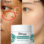 Charger l'image dans la galerie, Crème Anti-tache Visage et Corps - FRECKLE