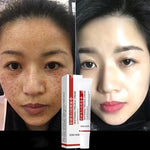 Charger l'image dans la galerie, Crème Hydratante Visage - Freckle