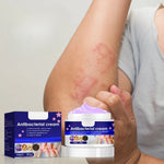 Charger l'image dans la galerie, Crème anti-démangeaison Antibactérienne