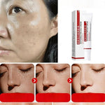 Charger l'image dans la galerie, Creme pour le visage anti tache - FRECKLE