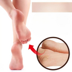 Charger l'image dans la galerie, Creme pour les pieds - Reparation du talon 300g