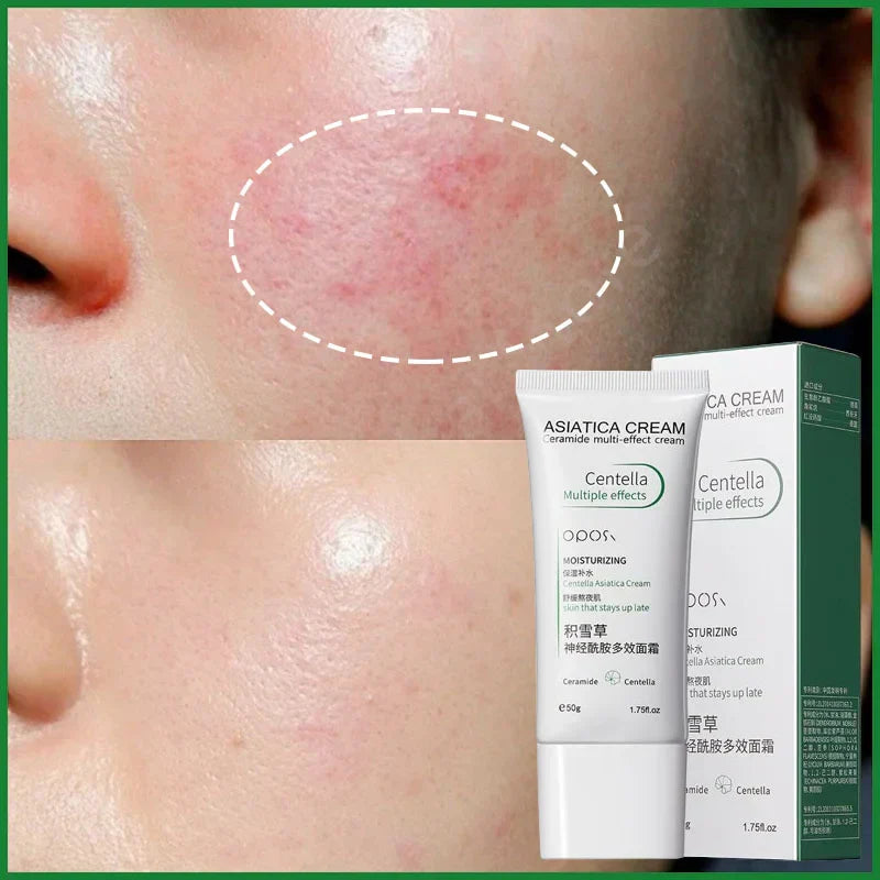 Crème Anti-Rougeur Visage - Centella