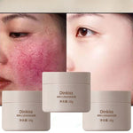 Charger l&#39;image dans la galerie, Creme Anti-Rougeur Visage - Dinkiss 3 pieces 
