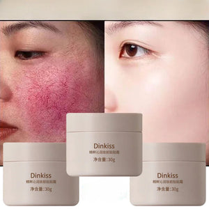 Creme Anti-Rougeur Visage - Dinkiss 3 pieces 
