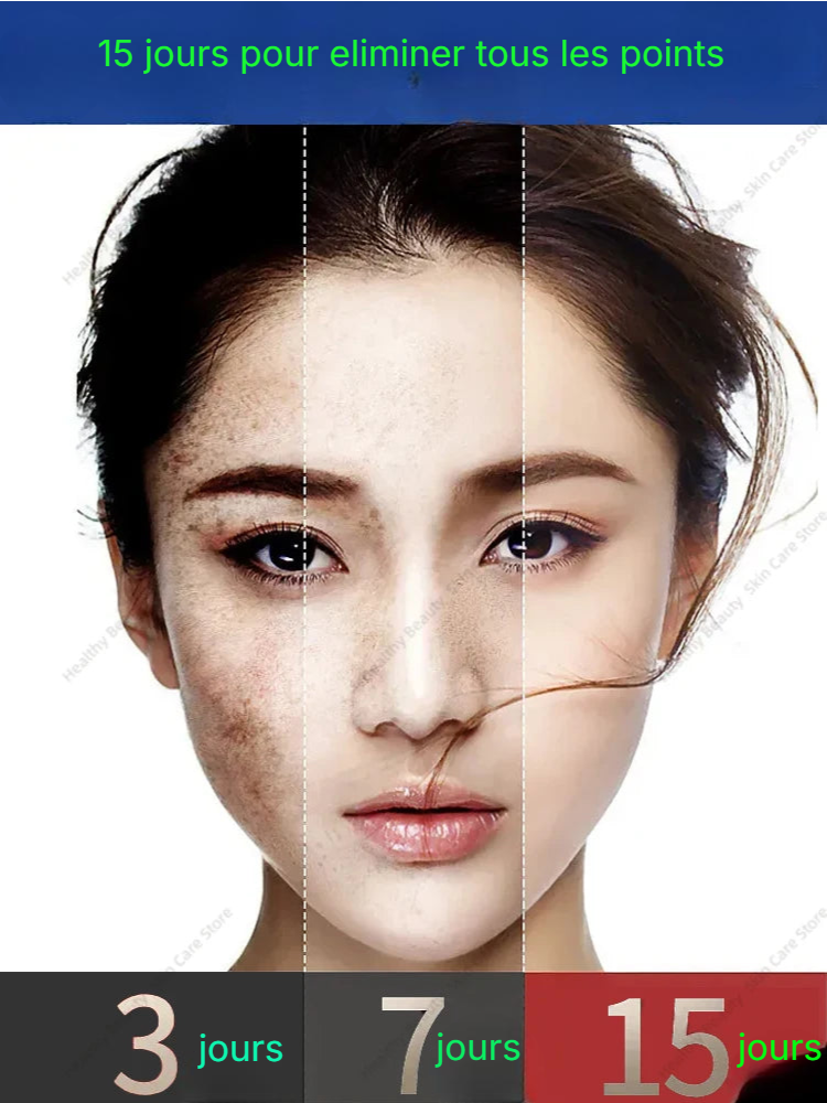 Crème Anti-Tache Nicotinamide - Freckle.