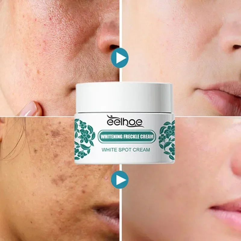 Crème Anti-tache Visage et Corps - FRECKLE