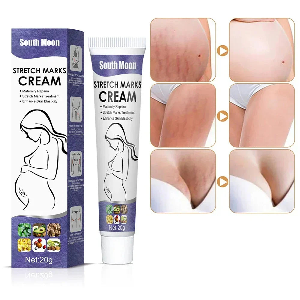Creme Anti-vergeture - Elasticite de la Peau 20g