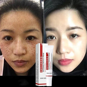 Crème Hydratante Visage - Freckle
