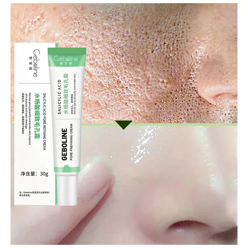 Crème Hydratante pour Visage - Acide Salicylique GEBOLINE