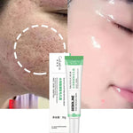 Charger l&#39;image dans la galerie, Crème Hydratante pour Visage - Acide Salicylique GEBOLINE
