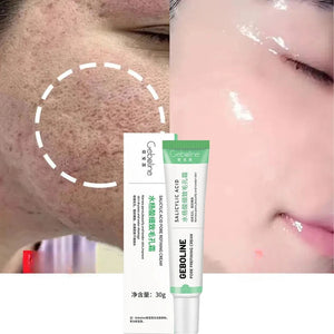 Crème Hydratante pour Visage - Acide Salicylique GEBOLINE