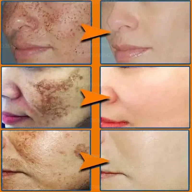 Crème Visage Anti Tache -  Andorheal