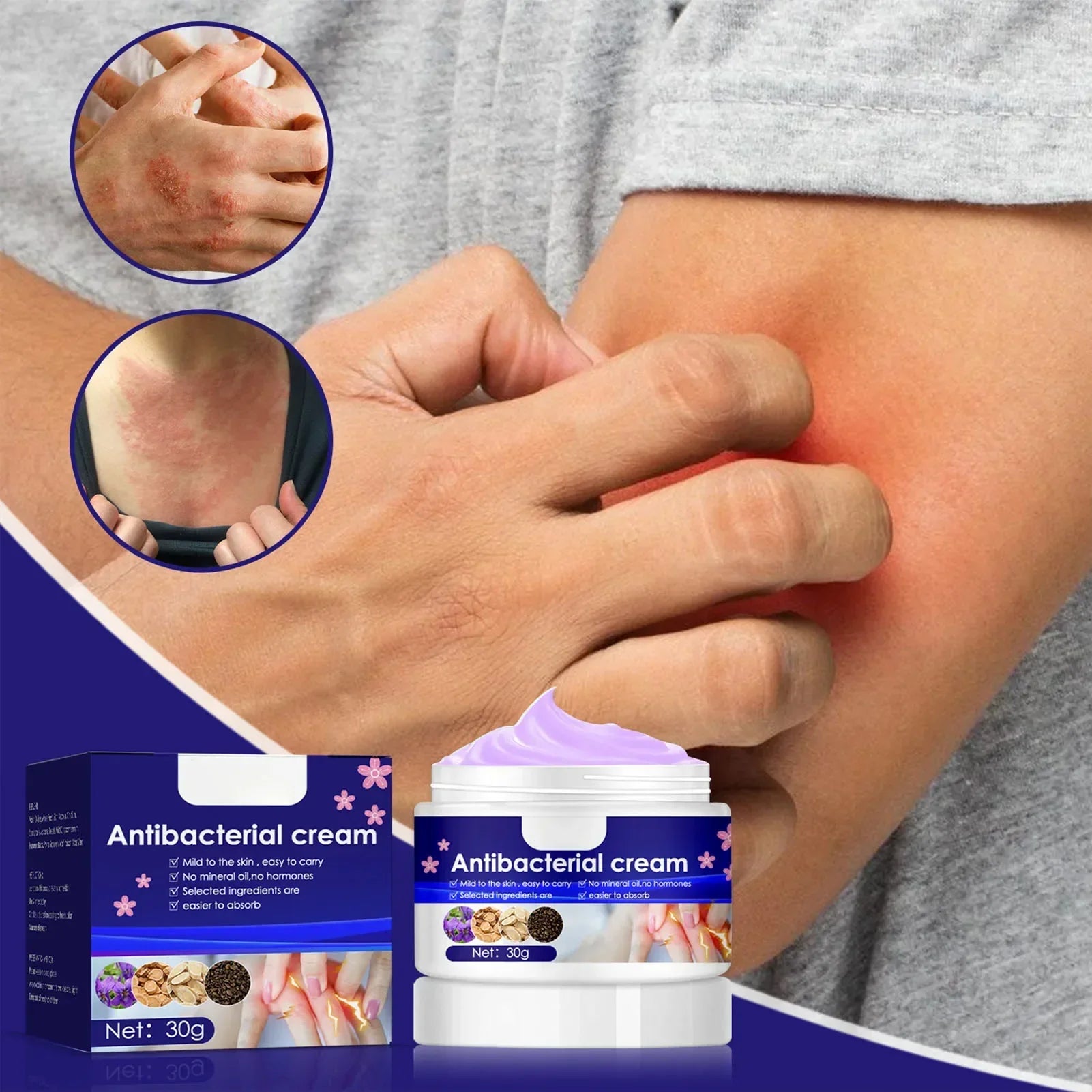 Crème anti-démangeaison Antibactérienne