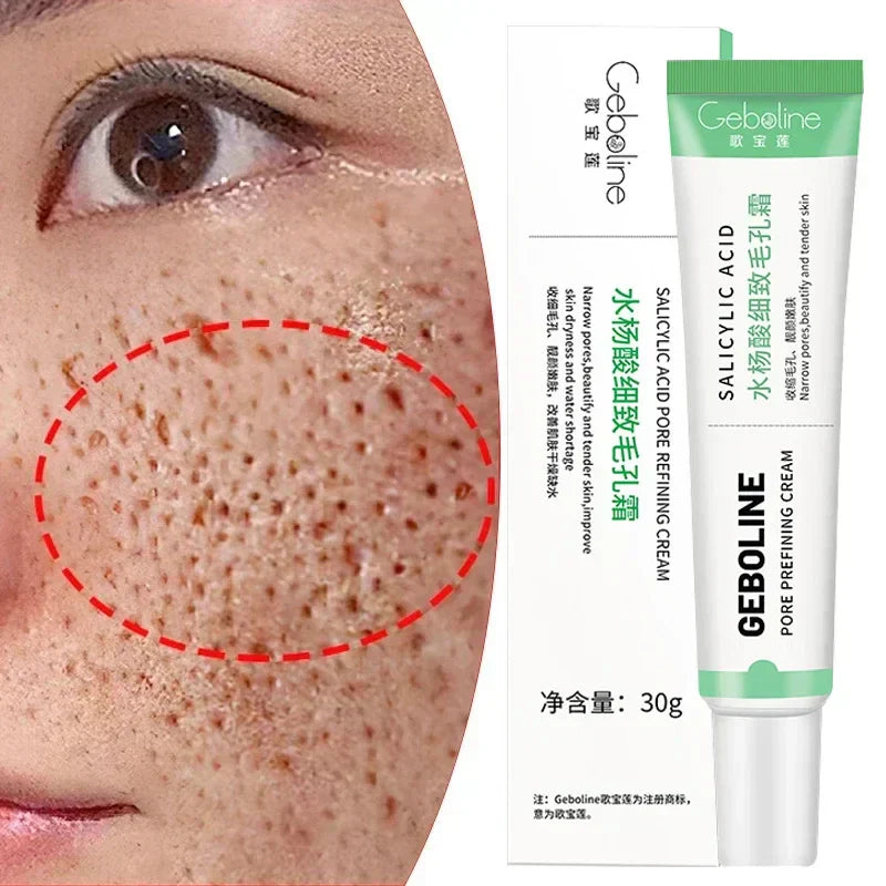 Crème pour Bouton Visage - GEBOLINE