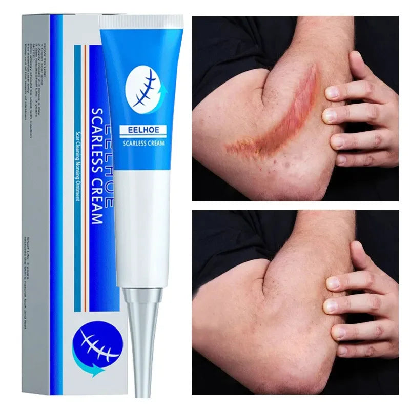 Crème pour Cicatrice Elhoe