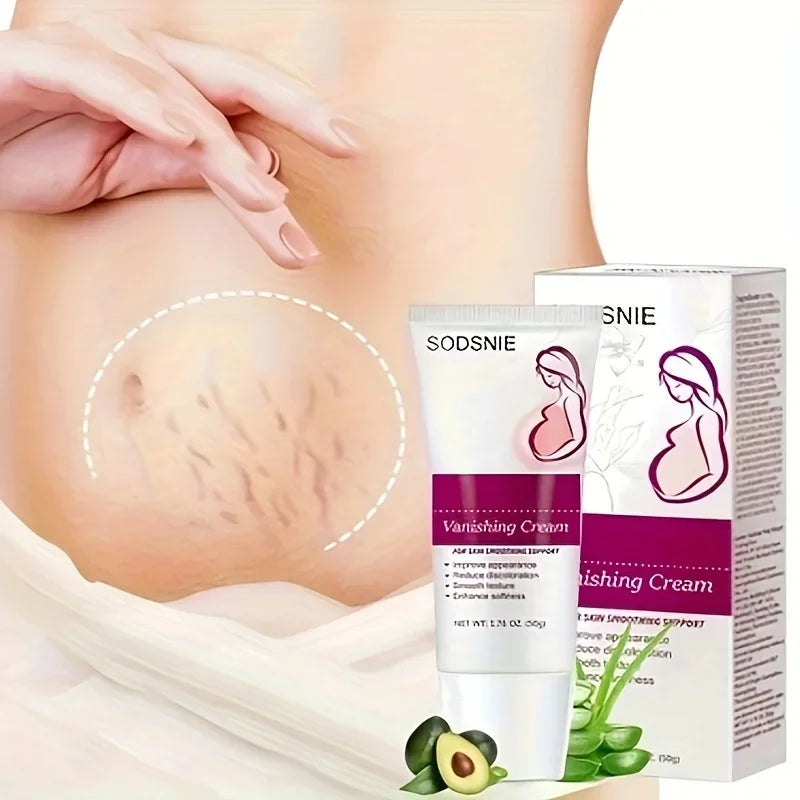 Crème pour Vergeture - Sodsnie