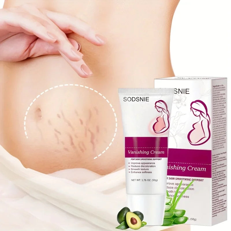 Creme pour Vergeture - Sodsnie 1