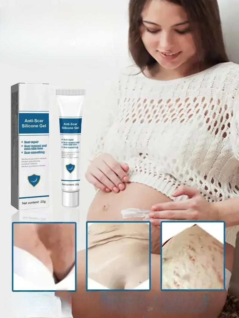 Creme pour Vergetures apres Grossesse 20g 3 Pieces