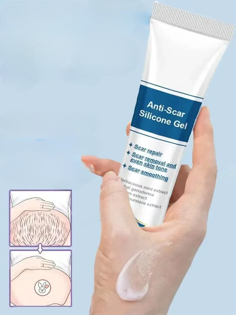 Creme pour Vergetures apres Grossesse 20g 3 Pieces