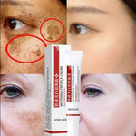 Charger l&#39;image dans la galerie, Creme pour le visage anti tache - FRECKLE
