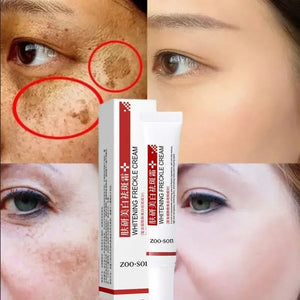 Creme pour le visage anti tache - FRECKLE