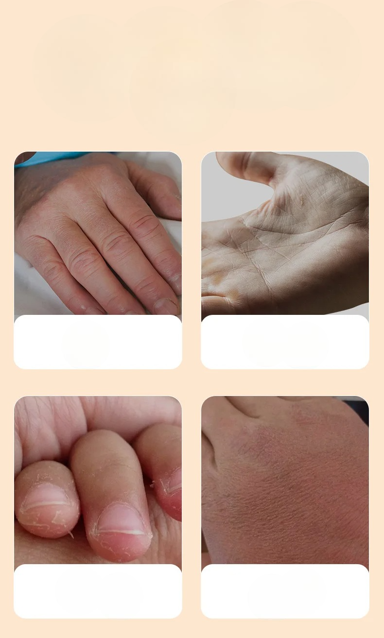 Creme pour les Mains Hydratante - ZHIDUO 10 Pieces