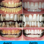 Charger l&#39;image dans la galerie, Dentifrice En Pâte 100g - Dentifrice Sans Fluor STRIDE
