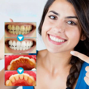 Dentifrice En Poudre - Stain Removal