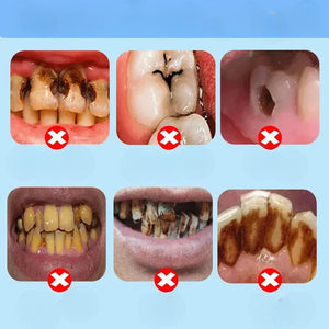 Dentifrice au Fluorure - Dentifrice en pâte - Eelhoe 30g