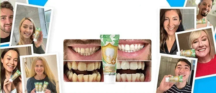Dentifrice au Fluorure - Dentifrice en pâte - Eelhoe 30g