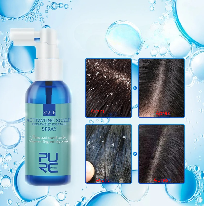 Huile Essence Anti-Démangeaison Cuir Chevelu 60ml