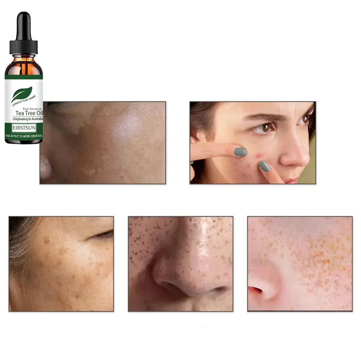 Huile Hydratante Visage - l'Huile d'Arbre à Thé Naturelle
