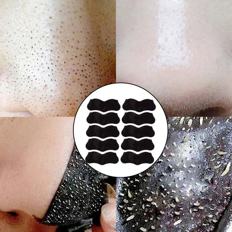 Masque pour Point Noir - Nettoyage Point Noir 
