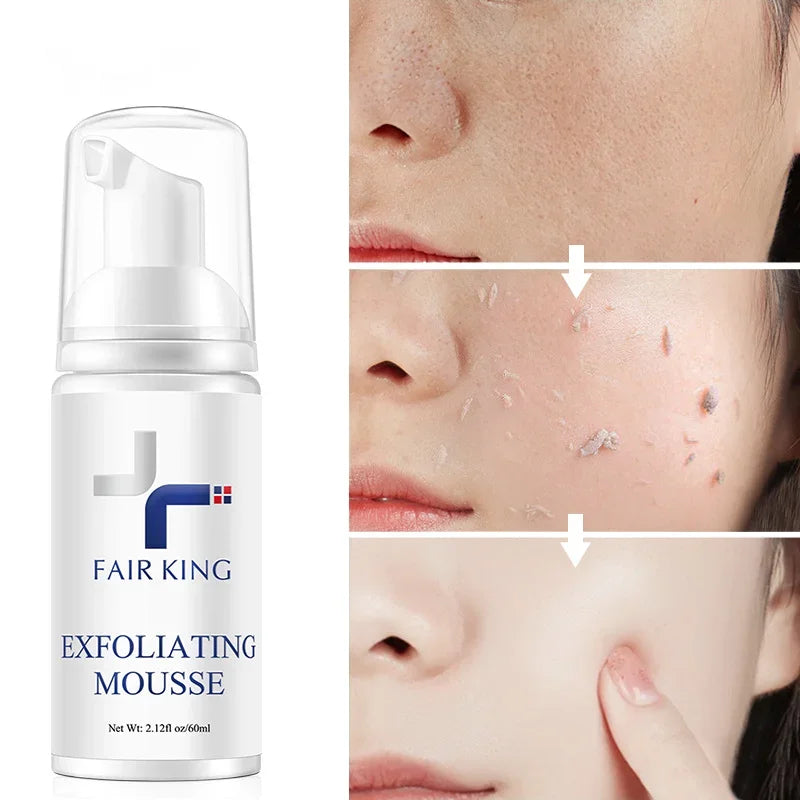Mousse Nettoyant Visage - FAIR KING