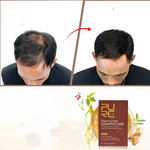 Charger l&#39;image dans la galerie, Savon shampoing solide anti-pelliculaire - PURC
