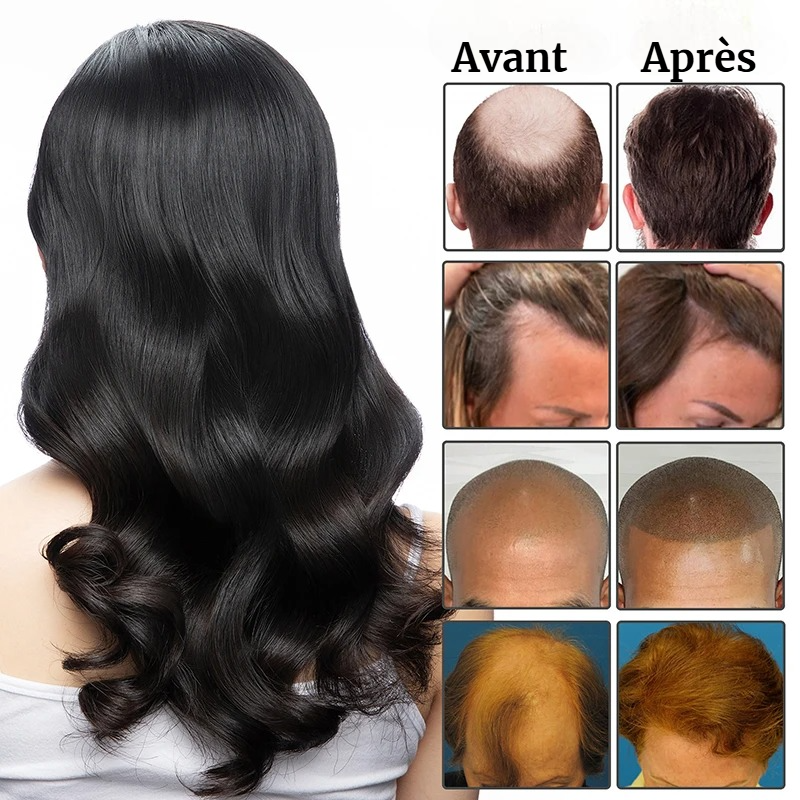 Traitement Antipelliculaire Naturel - Eelhoe après shampoing