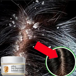 Charger l&#39;image dans la galerie, Traitement Antipelliculaire Naturel - Eelhoe après shampoing
