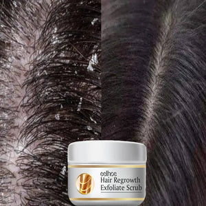 Traitement Antipelliculaire Naturel - Eelhoe après shampoing